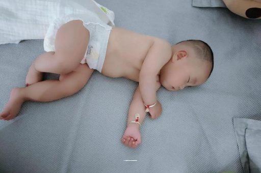 柳林六个月宝宝眼睛散光